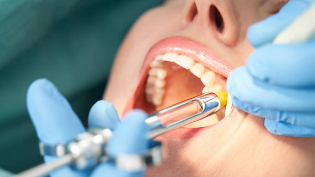 Painkillers vs Proper Dental Treatment