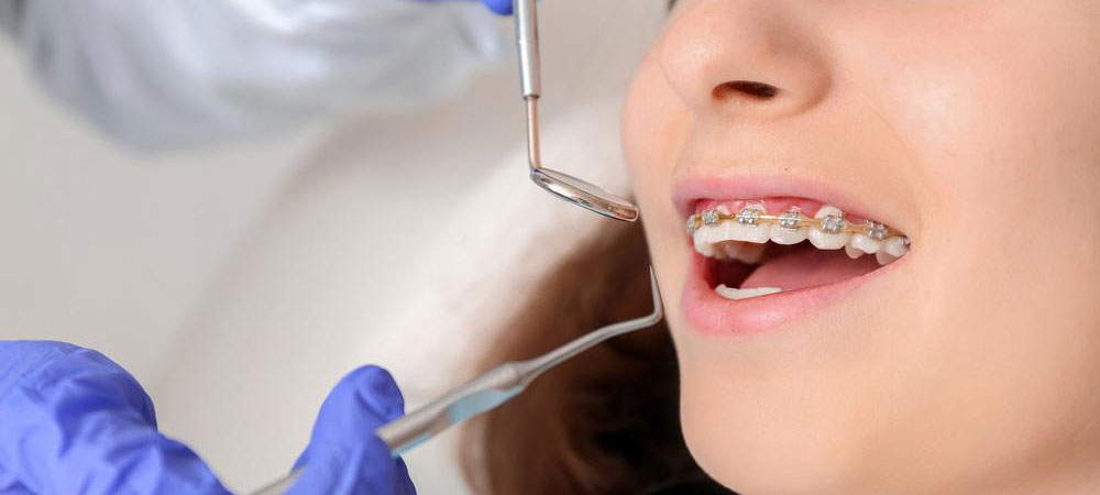 Top Braces Specialist in Kanpur