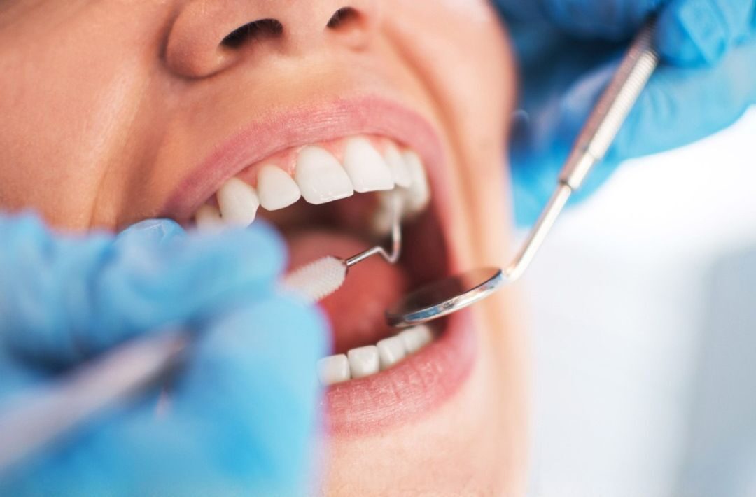 Best Dentist for Root Canal Treatment