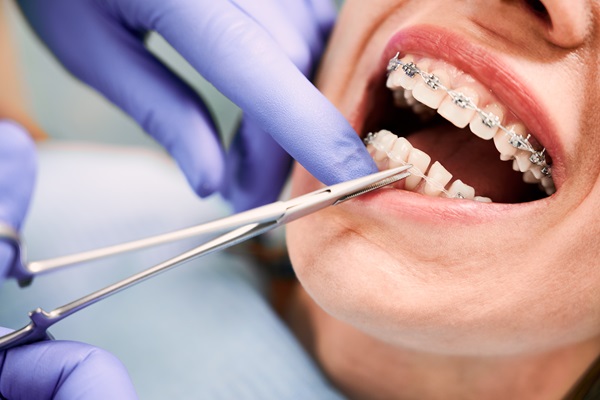 Top Braces Specialist in Sharda Nagar