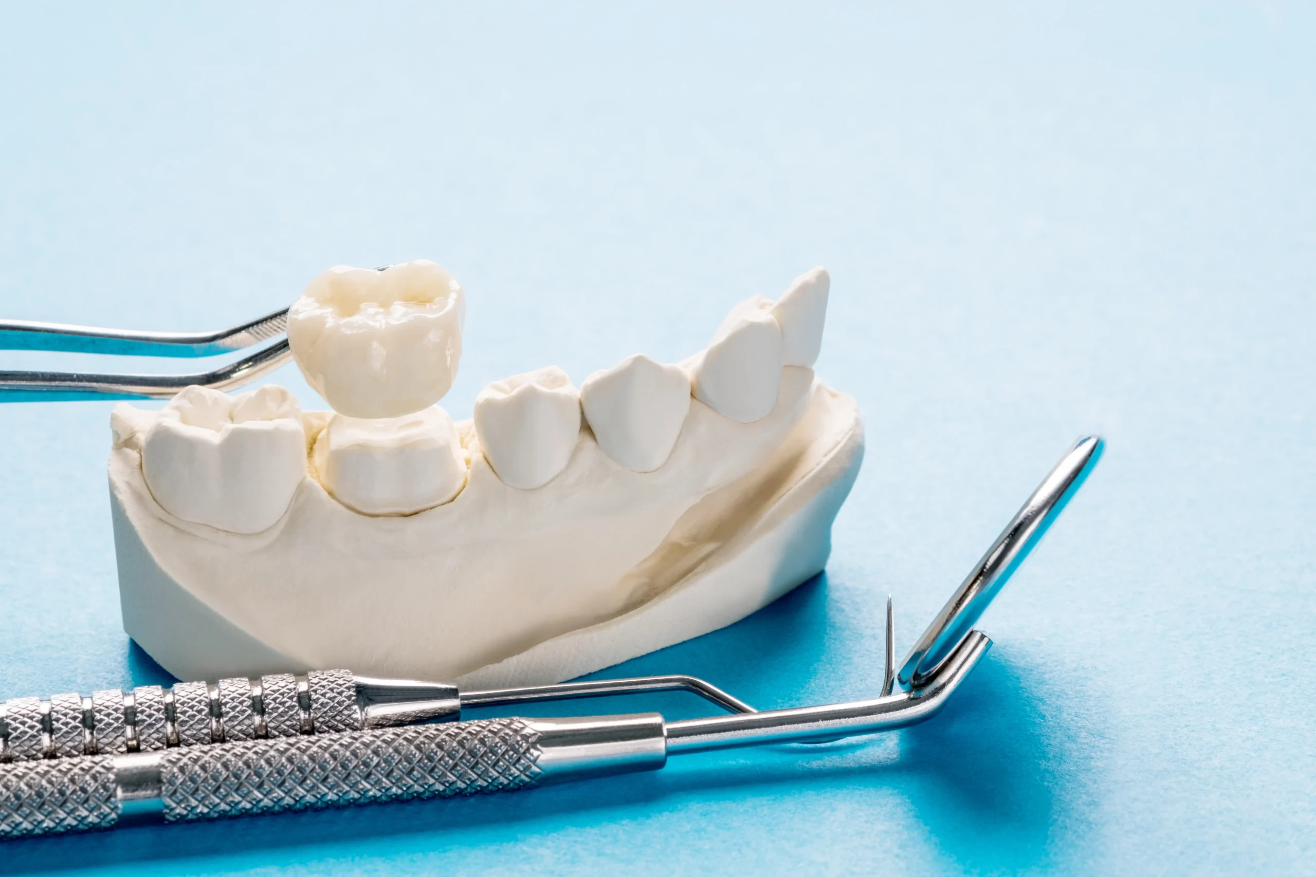 Best Dental Surgeon in Sharda Nagar